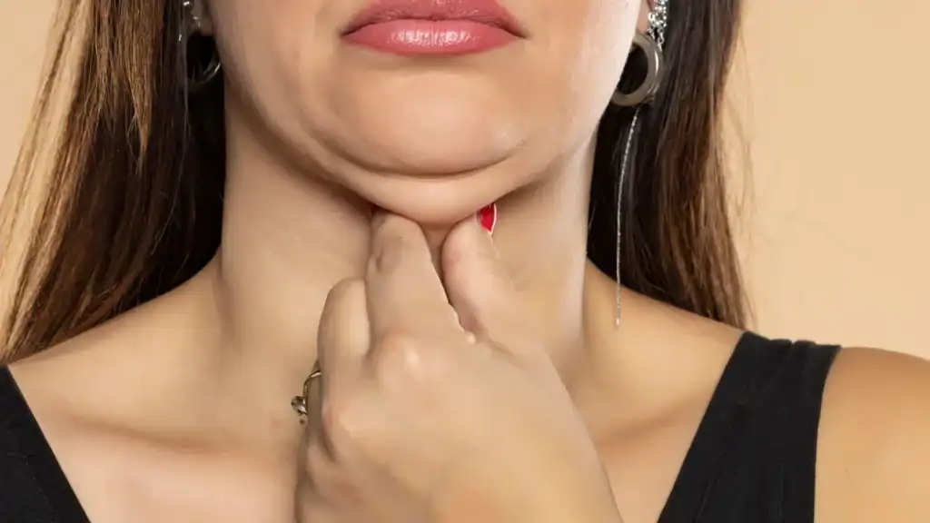 An image of a woman with double chin, sad, worried : Non Surgical Double Chin Removal Treatment in Spring Vale, UK